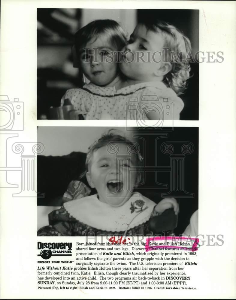 1992 Press Photo Katie and Eilish Holton in "Eilish Life Without Katie